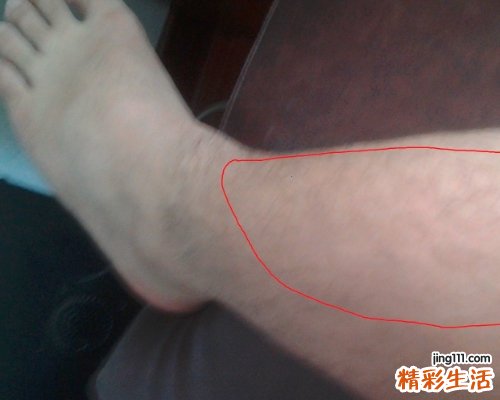 运动后肌肉酸痛怎么缓解