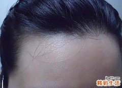 汗液颜色不同代表什么 汗液有异味是什么原因