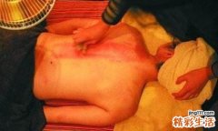 刮痧后容易出汗正常吗 刮痧后出汗是排毒吗