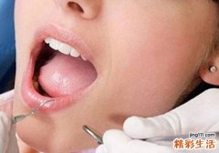 上火会不会导致月经推迟