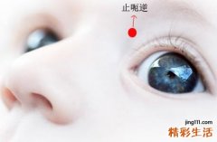 小儿打嗝的推拿治疗方法