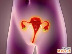 宫寒会有什么后果 宫寒惹来3种妇科病