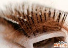 产后脱发到什么时候