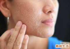 换季皮肤怎么保养