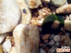 夏季痘痘护理不当小心引发炎症