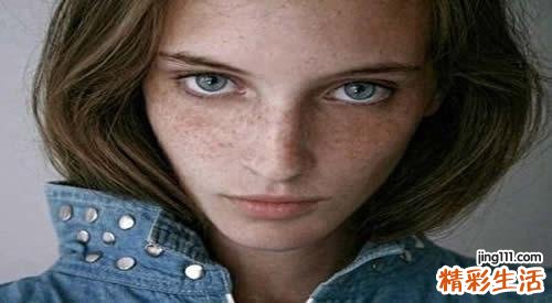 晒斑会自己消失吗