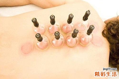 拔罐对肝脏有好处吗 肝经拔罐位置示意图