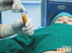 抽脂减肥的过程与效果