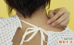 怀孕四个月全身瘙痒怎么回事