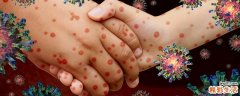 蚊虫水泡和病毒水泡的区别 疱疹病毒是什么引起的