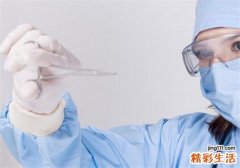 牛皮癣是什么引起的