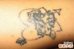 纹身能彻底洗掉吗