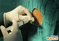 带状疱疹后遗症神经痛怎么治疗