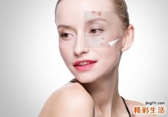痤疮可以吃什么食物 痤疮不能吃什么东西