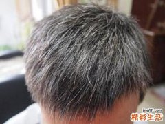 白发是什么原因造成的 白发与身体的关系