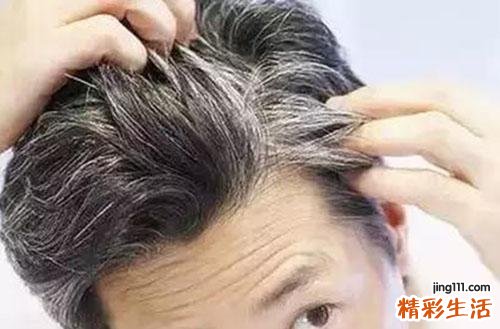 白发怎么治 这五个药方让白发再黑