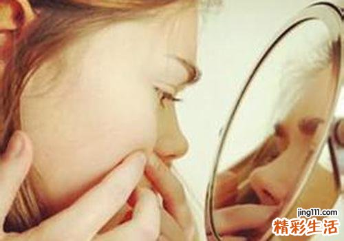 闭合粉刺一定要挤出来吗