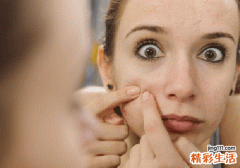 粉刺去除后怎么护理皮肤 这5点要做好
