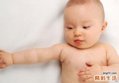 痱子就是湿疹吗 别把痱子当湿疹害了宝宝