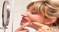 青春痘一般长到几岁