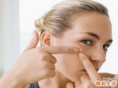 青春痘留下的疤痕怎么去掉 青春痘留下痕迹？这样做还你光滑肌肤