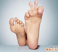 脚气怎么根治 预防脚气脚臭的方法