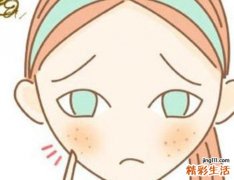 青春痘是怎么引起的 引发青春痘的原因