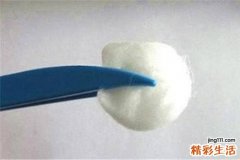 脚气可以用酒精消毒吗 脚气能用碘伏消毒吗