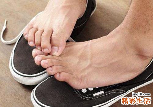 花露水可以治脚气吗 教你5招治疗脚气的方法