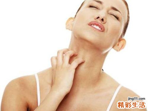 冬季皮肤病有哪些 你都知道怎么预防吗