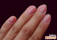 灰指甲有什么危害 六大危害要注意