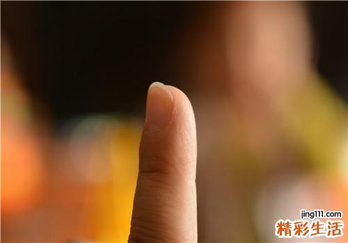 灰指甲会传染给别人吗 灰指甲的传染途径有哪些