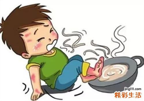 被开水烫伤后怎么止痛 开水烫伤后的处理方法