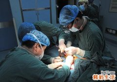 腋臭消融术会复发吗 腋臭消融术后如何降低复发概率