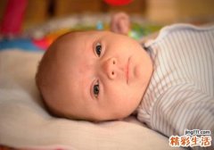 荨麻疹鸡蛋可以吃吗 荨麻疹不能吃什么