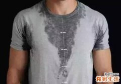 为什么紧张会出汗
