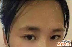 脾胃虚弱什么表现 脾胃虚弱常虚汗多