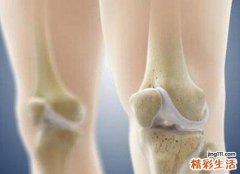 骨质疏松要怎么办 自我鉴别骨质疏松