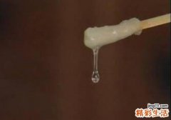 白带发黄是怎么回事