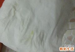 白带发黄怎样调理 白带发黄不能吃什么