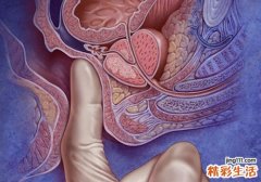 肛门瘙痒出血怎么检查 六种检查必须知道