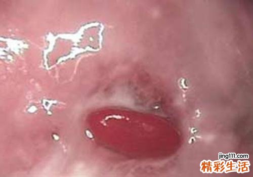 白带多而且稠是怎么回事