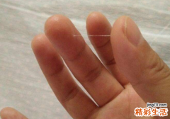 有透明的白带拉丝是不是排卵日 答案：不完全是，最好看这4点！