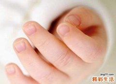 宝宝手上有倒刺怎么办
