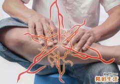 抽筋的症状