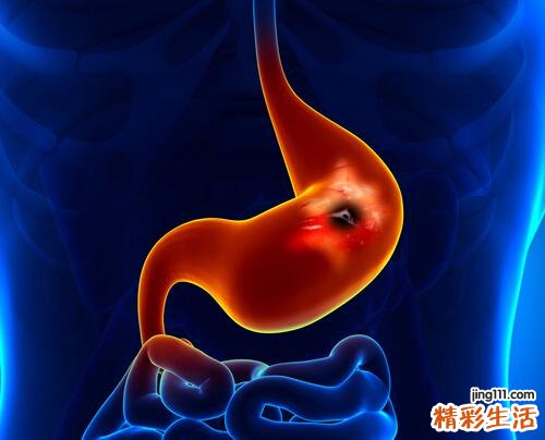 肠道健康决定寿命 您的秋季排毒包裹到了