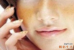 脸色发黄为什么 脸色发黄不是小事