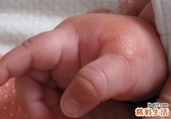 宝宝被蚊子咬出水泡要挑吗 宝宝被蚊子叮后起水泡