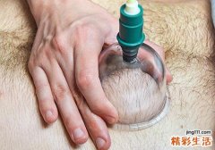 真空拔罐出水泡