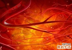 吃什么可以保护血管 这些食物帮你护住血管健康